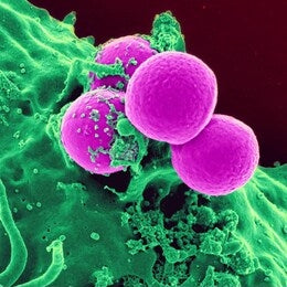What Is Staphylococcus Aureus In Food Sampling Failures?